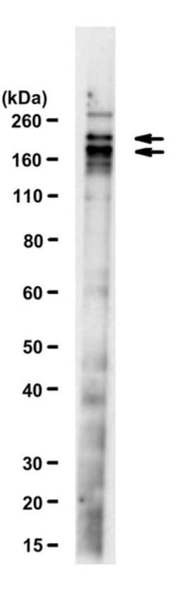 ESET (SETDB1), Mouse anti-Mouse, Clone: F0808, Millipore Sigma 25&mu;g;
